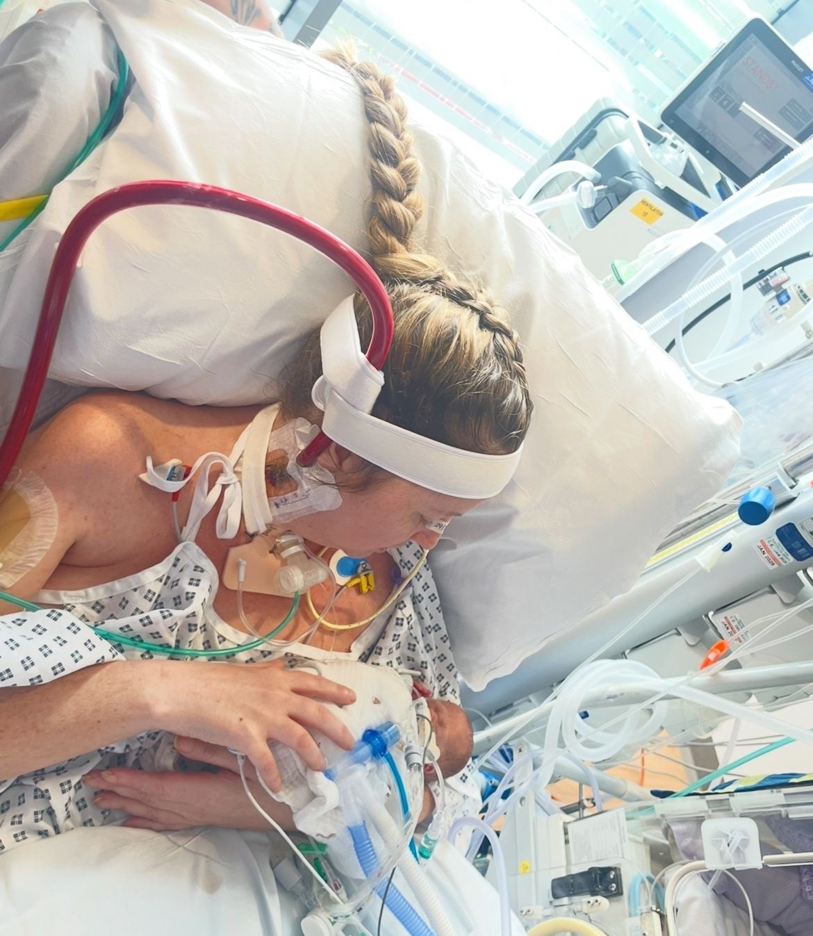 Photo of a lady sat up in a hospital bed cuddling a newborn baby. Both the lady and the baby are connected to several medical machines via tubes and wires.
