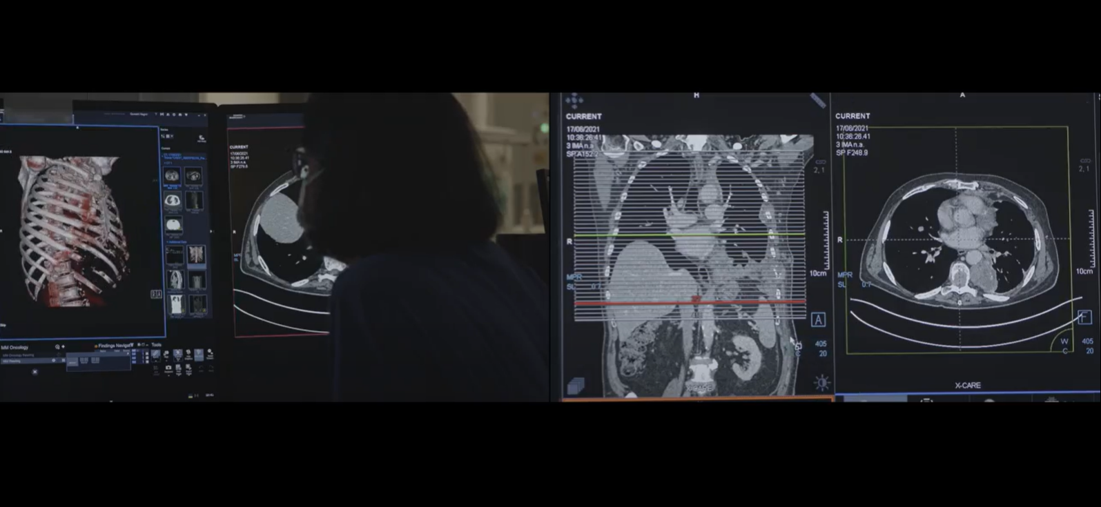 A clip from the film, showing CT scans of lungs on a computer screen