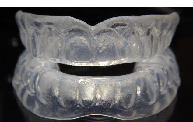 A mandibular advancement device, which looks like a plastic gum shield