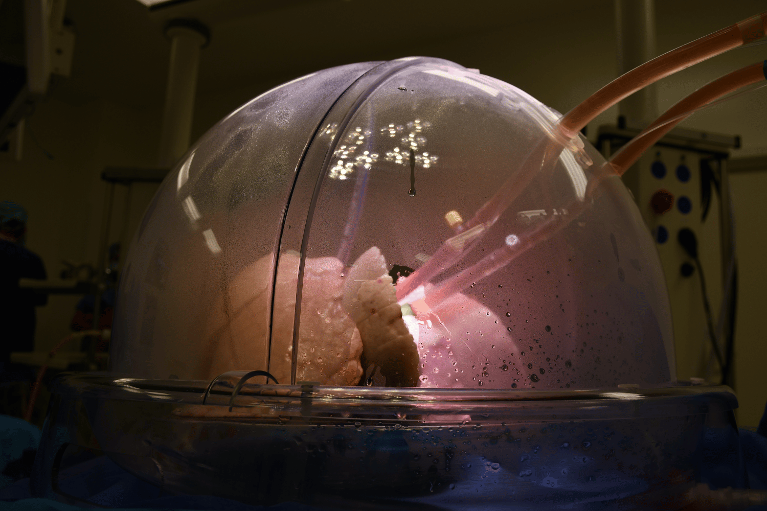 Pink lungs inside a transparent plastic, domed casing. 